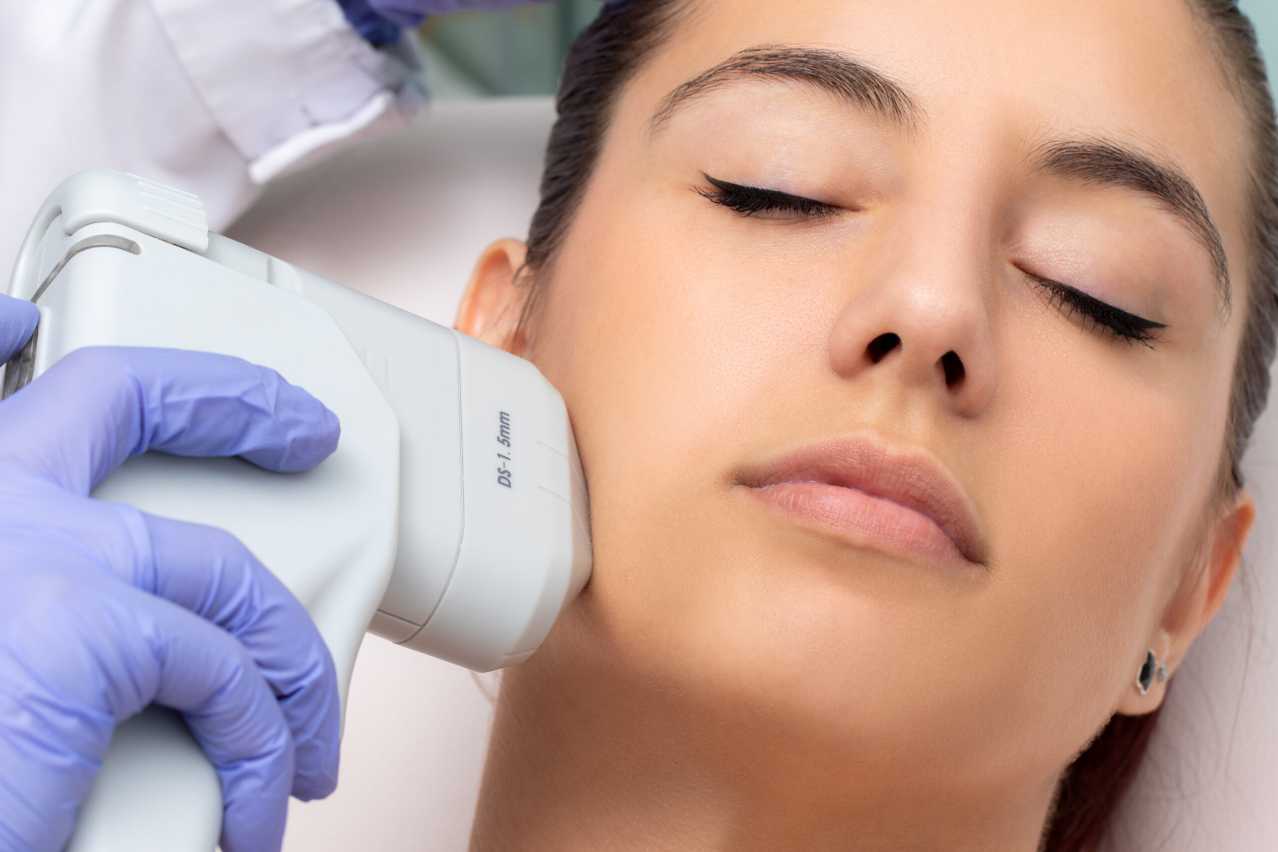 A HIFU facial treatment being performed at e-skin